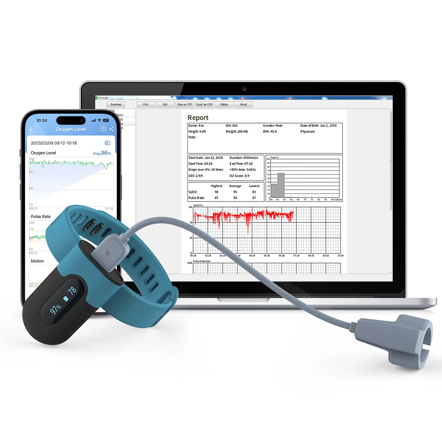 SleepU™ Wrist Oxygen Monitor