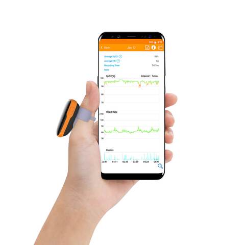 WearO2 Wearable Pulse Oximeter