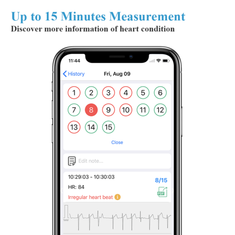 DuoEK™  Wearable EKG Monitor