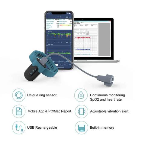SleepU™ Wrist Oxygen Monitor