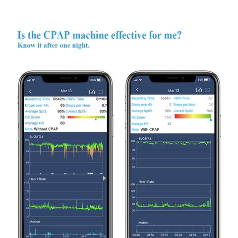SleepU™ Wrist Oxygen Monitor