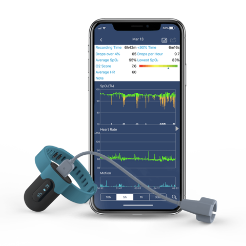 SleepU™ Wrist Oxygen Monitor